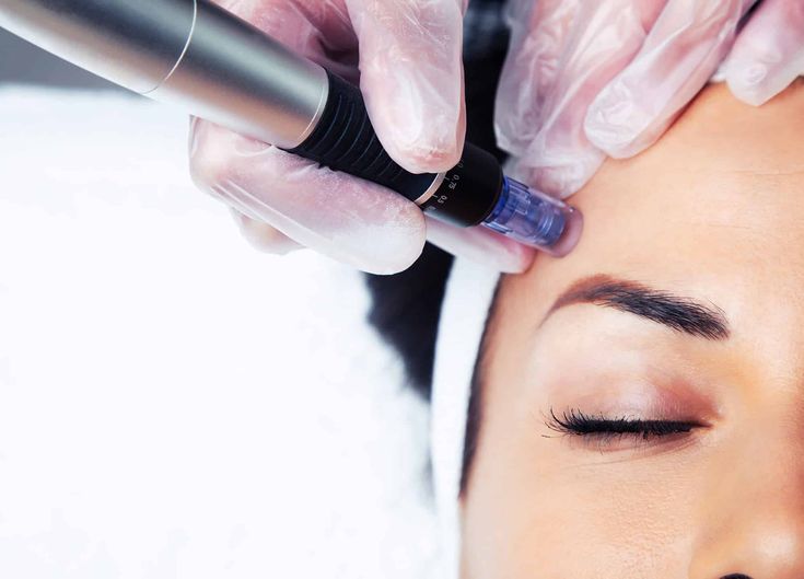 Microcurrent Therapy: Is This At-Home Device the Key to Tighter Skin?